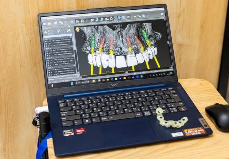 CTシュミレーション