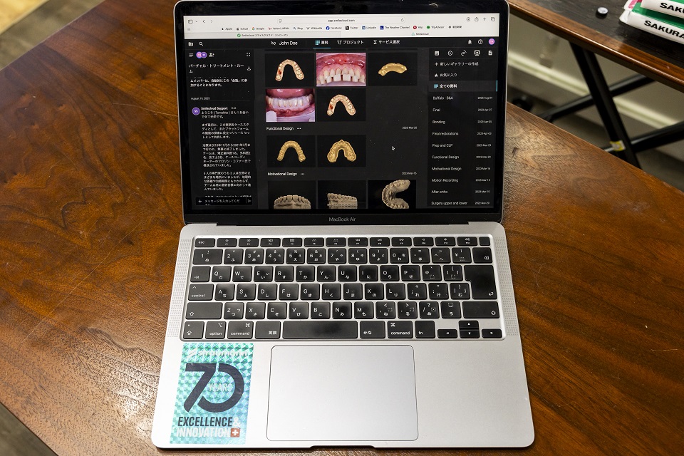 骨が少なくてもできるインプラント治療とは