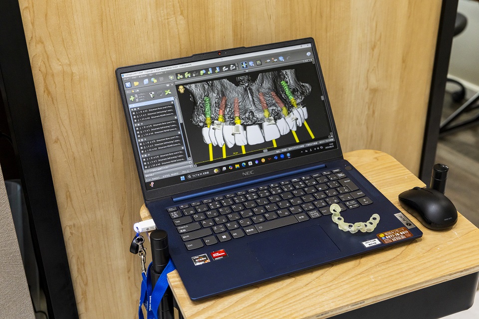 全顎治療にも対応