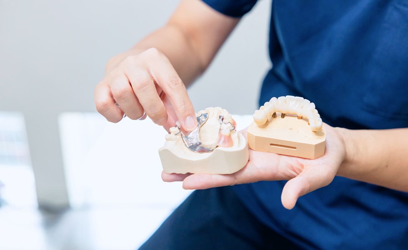 入れ歯治療について
