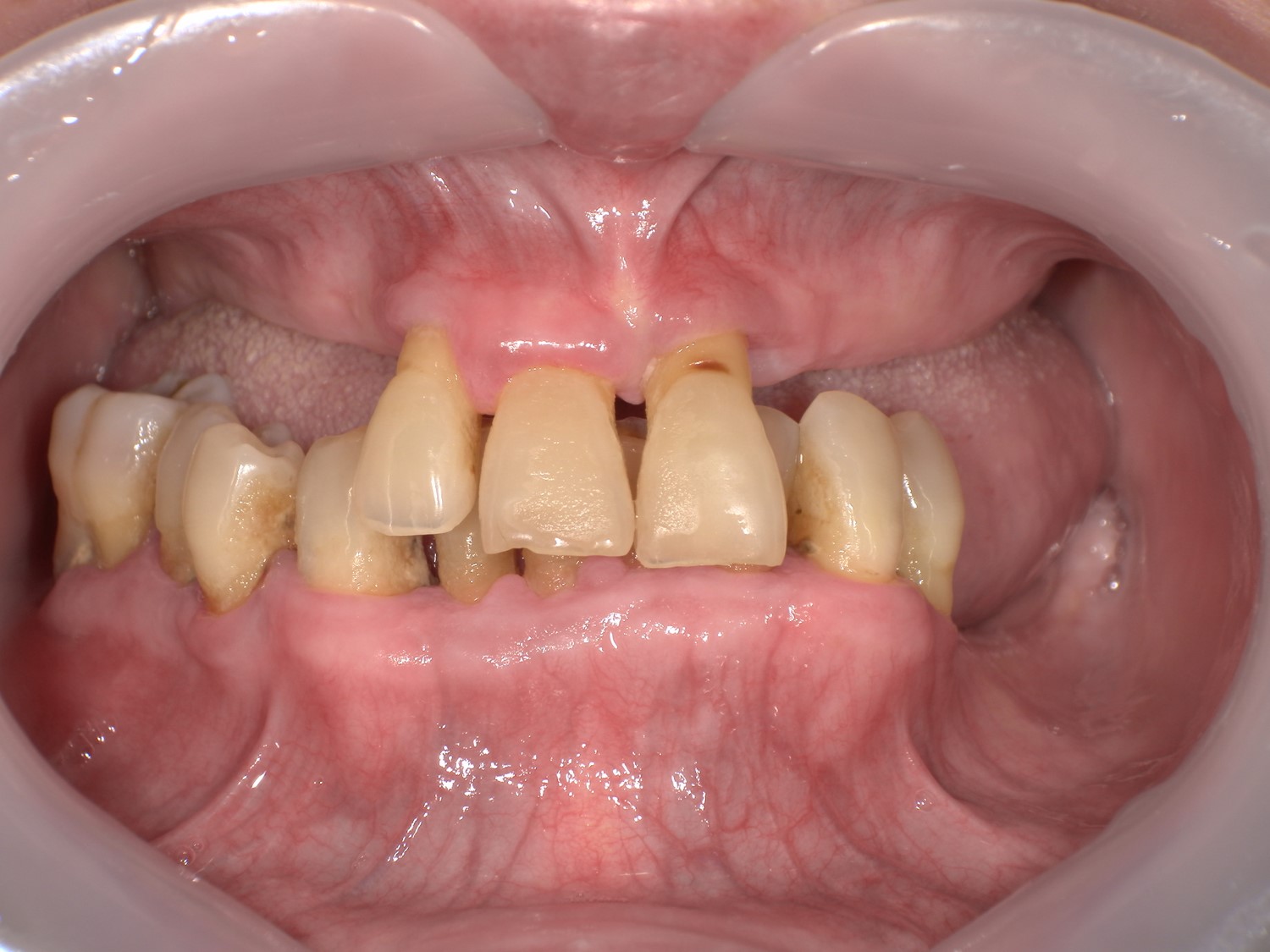 Before
